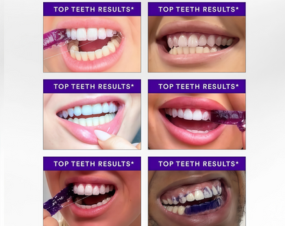 V34 Whitening Strips